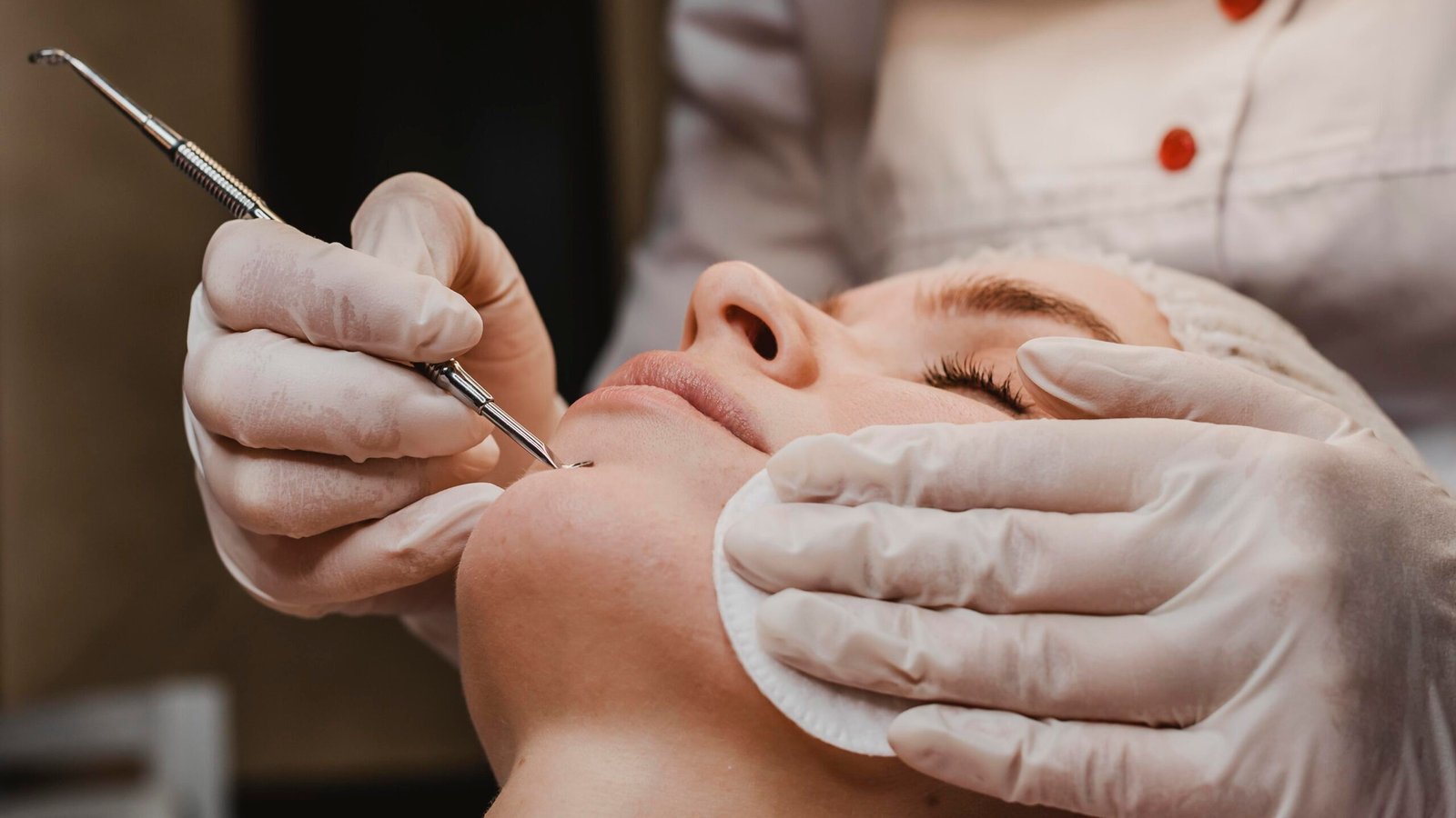 Acne scar laser treatment
