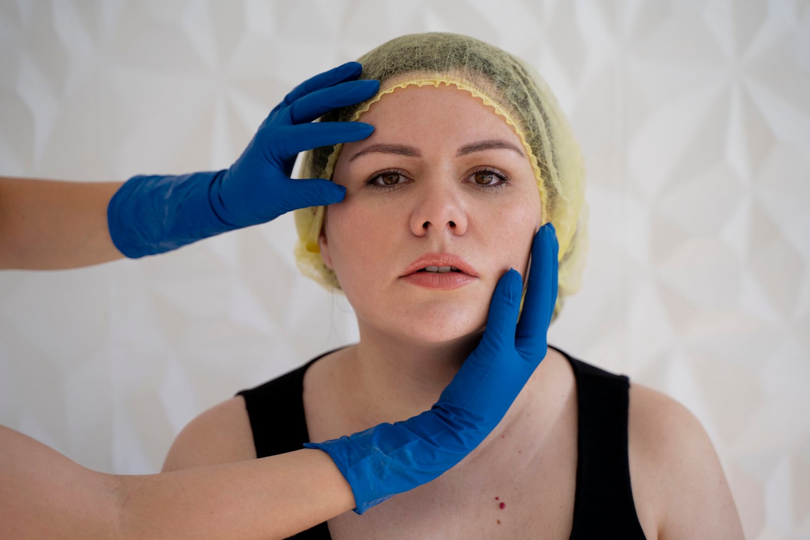 facelift treatment