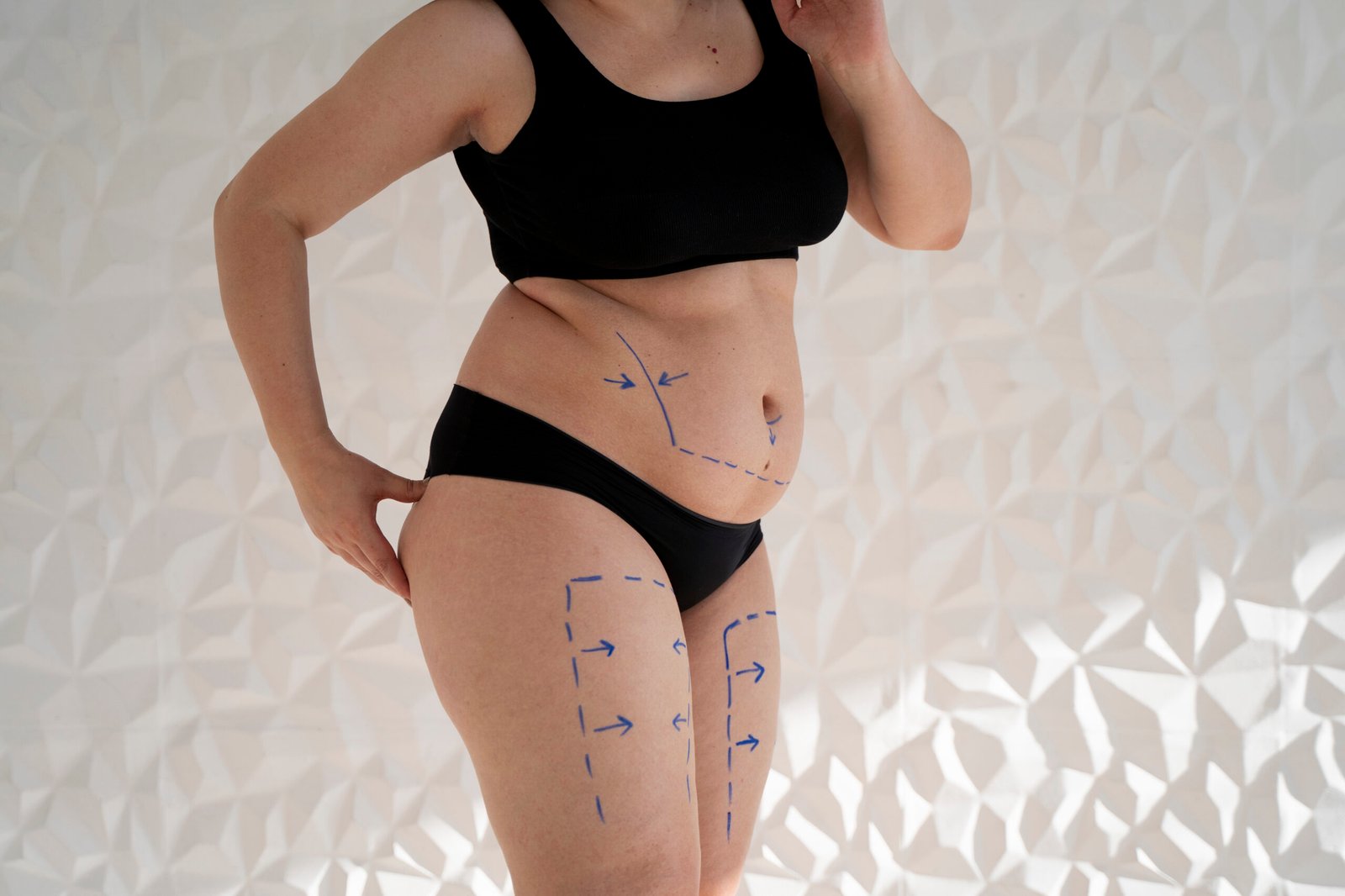 tummy skin removal treatment