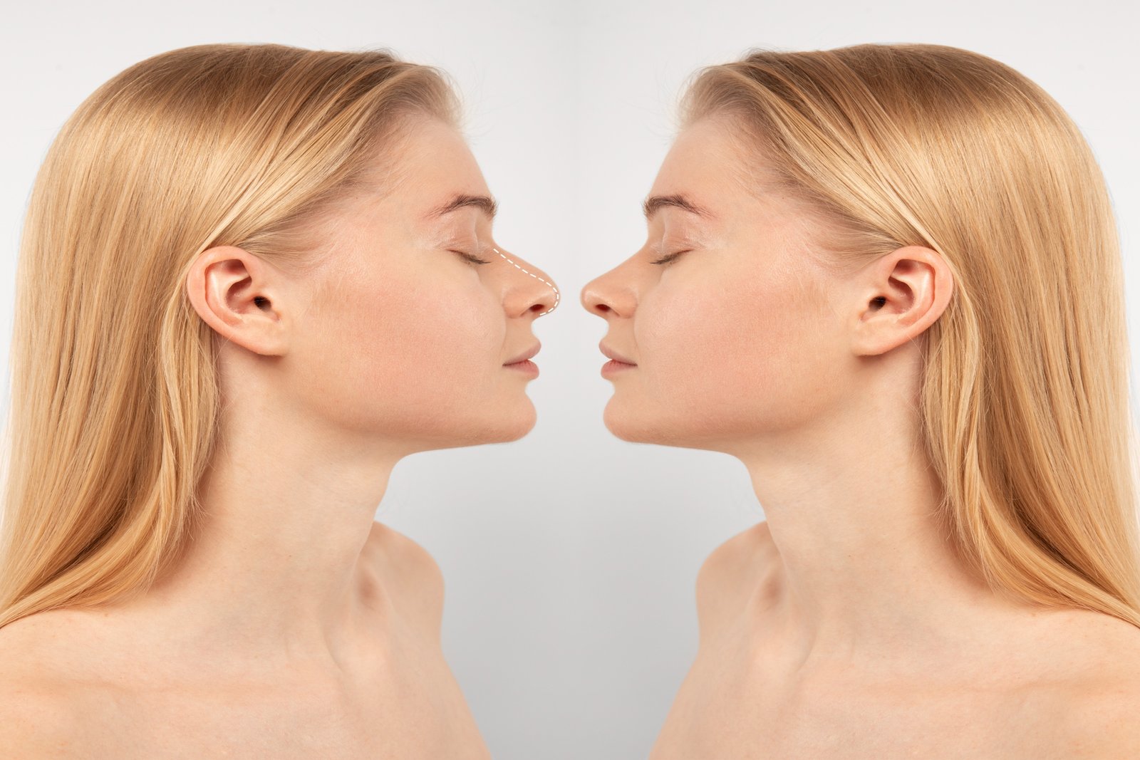 rhinoplasty-surgery-concept-with-woman-model.jpeg